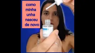 Como minha unha cresceu de novo/ minha unha caiu, como recuperei.