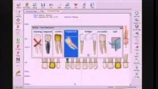 Florida Probe Mock Patient Exam, Part 1