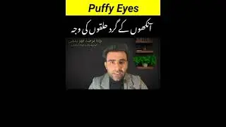 DrShaheen: Puffy eyes & route cause of dark circles | ankho k gird halko ki asal waja #puffyeyes