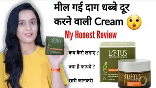 Lotus Phyto Rx AntiI-Blemish Cr&egrave;me Review For Pigmentation,Scars, Dark Circles, #MissBairagi
