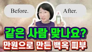 같은 사람 맞나요? 비싼 미백 화장품 쓰기 전에 제발 이거부터 해보세요! 만원으로 만든 백옥 피부 ✨