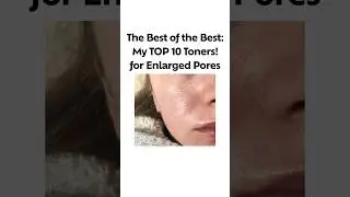 The Best of the Best: My TOP 10 Toners! for Enlarged Pore