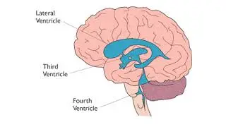 Brain Lecture Scans, Hemispheric Specialization and Split Brain - Murphy