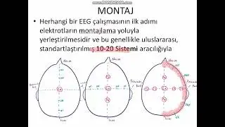 EEG Konu Anlatımı/ Dr Taylan BEKTAŞ