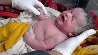 Newborn Baby Received from Labour Room | Initial Assessment in NICU