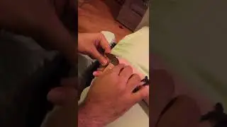 Goniometry- Finger flexion at the MCP, PIP, and DIP