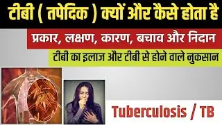 टीबी रोग के लक्षण, कारण, इलाज || tb ki bimari kaise hoti hai || tb ki bimari ke lakshan in hindi