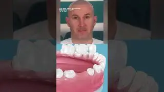 HOLYWOOD SMILE? 😁💫 Dentysta: NIE dla WSZYSTKICH! (Kiedy SUBTELNOŚĆ jest WAŻNIEJSZA od EFEKTU WOW!
