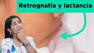 Retrognatia y lactancia