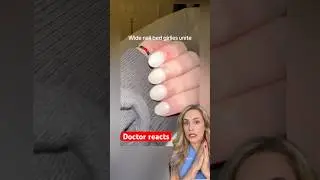 What&rsquo;s wrong with these nails?!