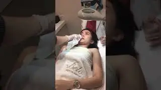 Laser Mole Removal