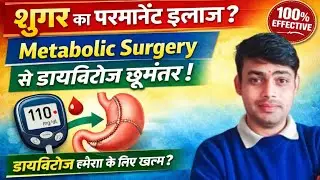 शुगर का परमानेंट ईलाज।Metabolic Surgery से Diabetes हमेशा के लिए ठीक? | Doctor Explain