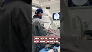 Embolização de Mioma