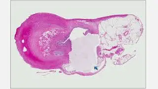 2025 A Practical Approach to Surgical Pathology: Volume XI