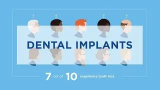 Dental Implants: Long-term Solution (1:09)