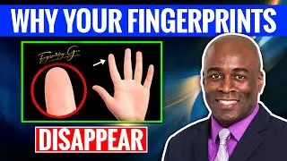 Why Your Fingerprints Disappear.