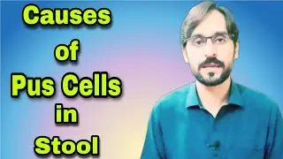 Pus Cells in Stool | Causes of Pus Cells in Stool