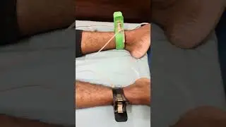 How to do ECG | ECG कैसे करे । Electrocardiogram #ecg #shorts #health #nurses #heart #doctor #views