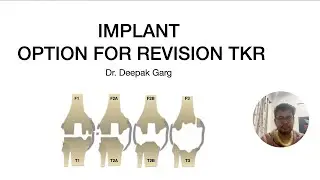 STEPS TO IMPLANT SELECTION FOR REVISION TOTAL KNEE REPLACEMENT (rTKA)