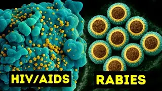 Viruses Under Electron Microscope HD