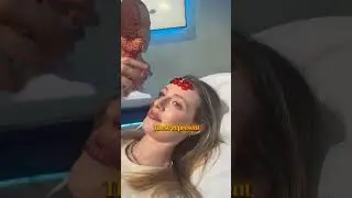 Perch&eacute; disegno cerchi sui miei pazienti per i trattamenti di Botox