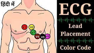 ECG in Hindi || 12 ECG Lead Placement || ECG Lead Color Code || ECG Lead Position || Nursing || GNM