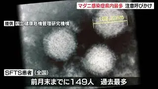 マダニ媒介感染症「SFTS」患者数が過去最多　全国で急増、大分県で13人