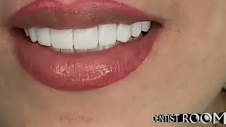 Smile Closeup Dental Veneers