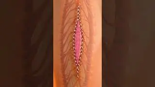 How Stitches Works😯#whatif #facts #science #hindi #shorts #reels #tiktok #status