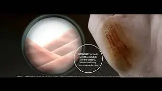 BETADINE&reg; Antiseptic Solution
