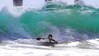 015 -Christiaan &ldquo;Otter&rdquo; Bailey - From Skateboarding Crash to Recovering Paraplegic, the...