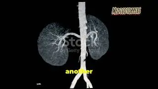 Flea bitten kidney - Mnemonic #aiapget #medicine notes #practiceofmedicine #neetpg