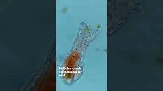 This Philodina roseola is a MACHINE! 😮