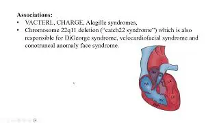 Right Side Obstructive Lesions (part 1of 2)