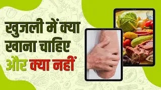 Khujli Mein Kya Khana Chahiye Aur Kya Nahi | Khujli Ke Liye Kya Karen