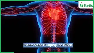 How ECMO Saves Lives in Sudden Cardiac Arrest | Dr. Sandeep Dewan - Fortis Hospital