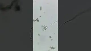 Glockentierchen Vorticellidae under the microscope #science #microscope 5