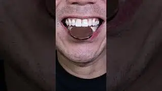ASMR | Chocolate Coin CRUNCH! 🪙🍫 #DoctorTristanPeh #ASMR