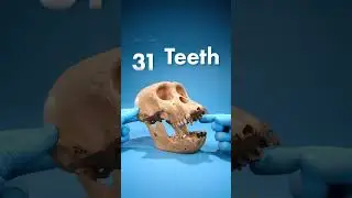 What Mammal Has The Most Teeth?