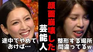 【有益2ch】美容医療やりすぎて顔面崩壊！整形しすぎた芸能人【ガルちゃん】
