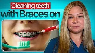 🦷 How to Clean Teeth with Braces Properly | Hygienist Heather