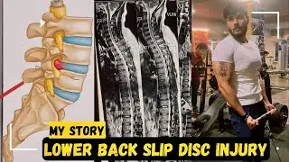 My Lower Back Slip Disc Injury 😔 ||How I Fixed IT NATURALLY 🧿 #shreyashyadavvlogs