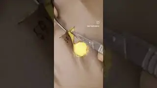 #biologyexplained