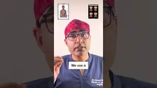 Get a Natural Look after Breast Implants| Breast Implants Surgeon in India | Breast Surgery in India