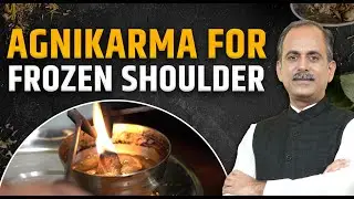Agni Karma | Frozen Shoulder Treatment | Acharya Manish Ji | HiiMS Therapy