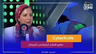 #حياتك_صح | د/ ايمان الديباوي توضح كيفية علاج السرطان بجهاز الـ cyberknife
