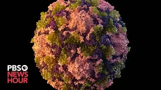 Public health experts sound the alarm as new polio cases emerge