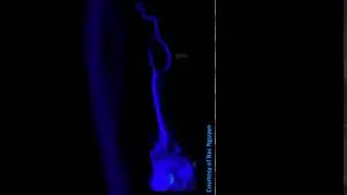 MR Head Neck Imaging &ndash; 4D flow outside the cardiac @ Siemens 1.5T