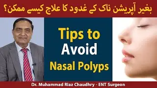 Naak ke Gadood ka ilaj |Naak Ke Gadood ki Alamat kya hain? | How to Treat Nasal Polyps In Urdu/Hindi
