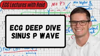 The Sinus P Wave (High Yield ECG)